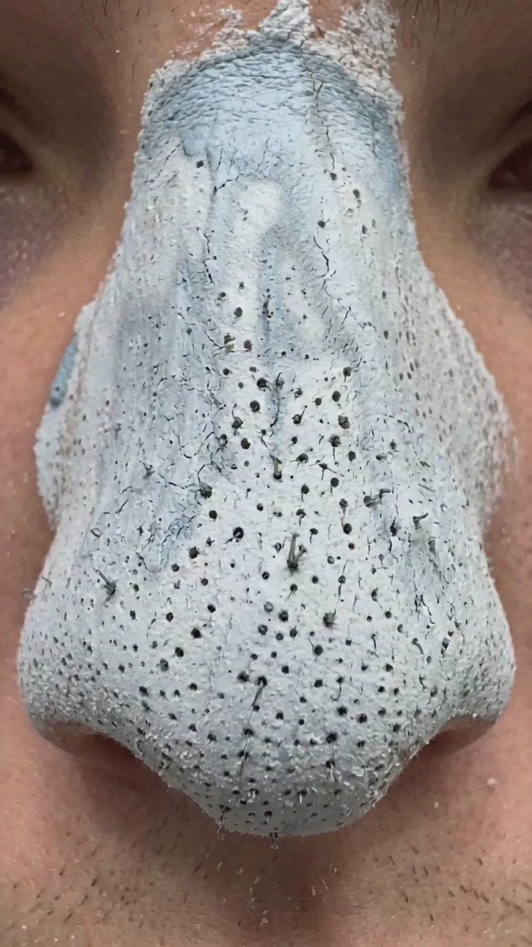 medicube Zero Pore Mask - UGC video ad